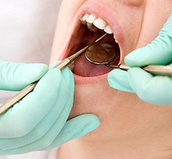 Woman’s mouth being examined