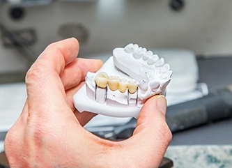 Dental bridge in Dix Mills on a clay model