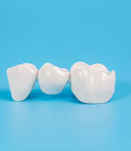 Dental bridge on a blue background