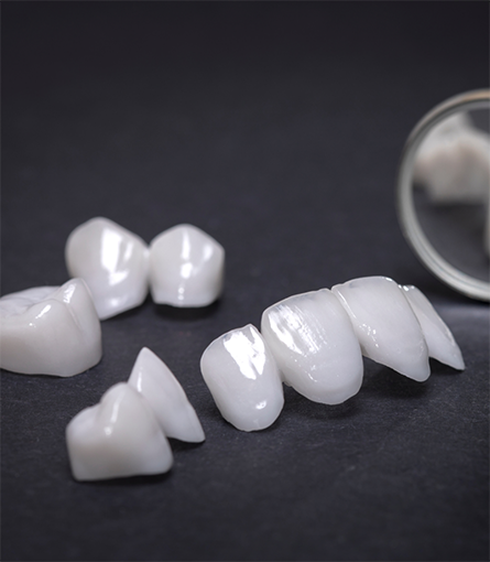 Multiple veneers lying on a grey surface